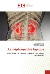 La néphropathie lupique