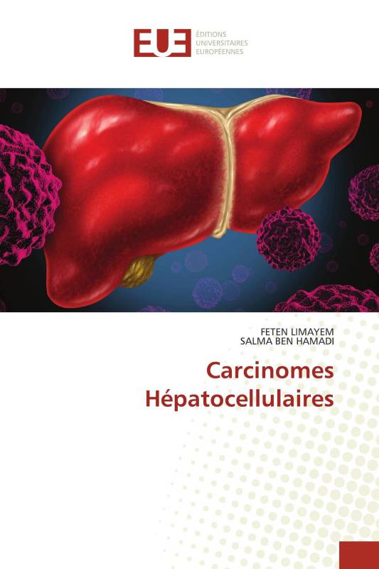 Carcinomes Hépatocellulaires