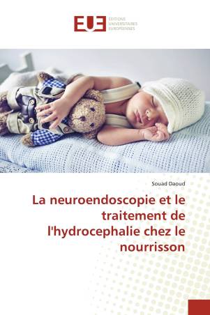 La neuroendoscopie et le traitement de l&#039;hydrocephalie chez le nourrisson