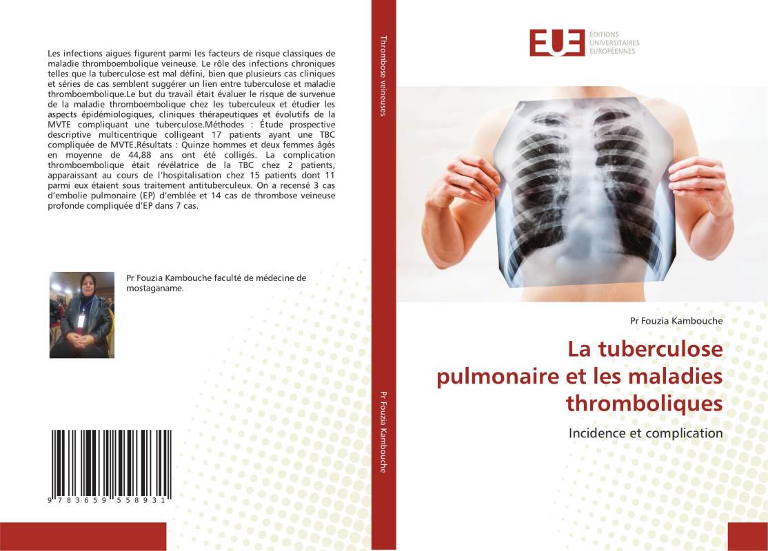 La tuberculose pulmonaire et les maladies thromboliques