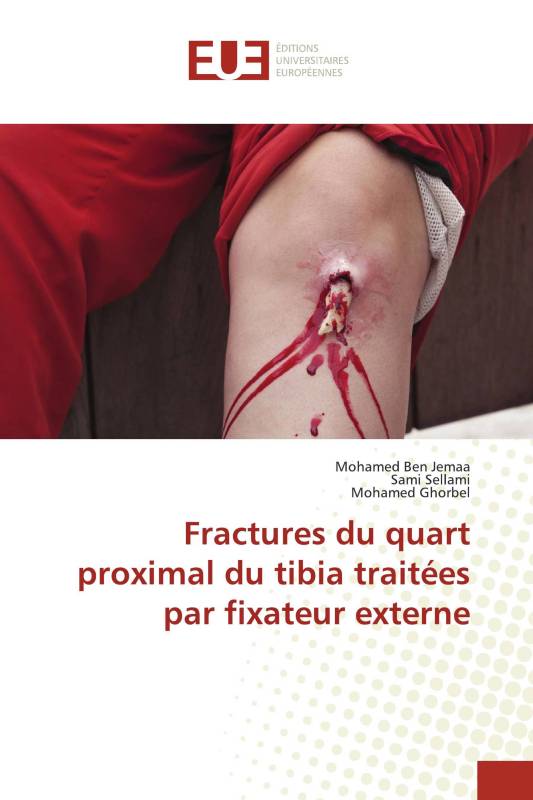 Fractures du quart proximal du tibia traitées par fixateur externe