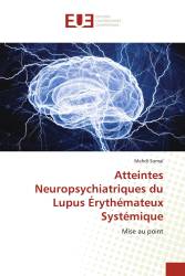 Atteintes Neuropsychiatriques du Lupus Érythémateux Systémique