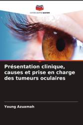 Présentation clinique, causes et prise en charge des tumeurs oculaires