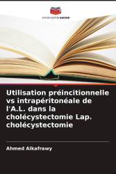 Utilisation préincitionnelle vs intrapéritonéale de l'A.L. dans la cholécystectomie Lap. cholécystectomie