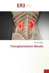 Transplantation Rénale