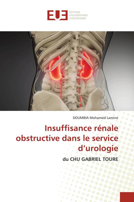 Insuffisance rénale obstructive dans le service d’urologie