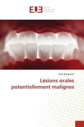 Lésions orales potentiellement malignes