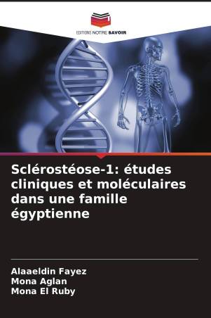 Sclérostéose-1: études cliniques et moléculaires dans une famille égyptienne